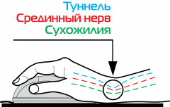 Компьютерные браслеты. Защита запястья и комфорт при работе с ПК Компьютерные браслеты. Защита запястья и комфорт при работе с ПК